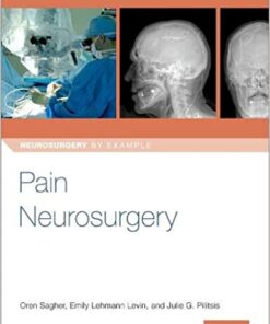 Pain Neurosurgery (Neurosurgery by Example) 1st Edition PDF