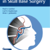 Video Vascular Challenges in Skull Base Surgery 1st Edition PDF Original & Video