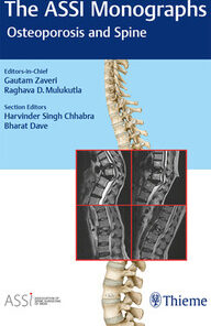 The Assi Monographs Osteoporosis And Spin PDF