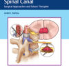 Tumors of the Spinal Canal: Surgical Approaches and Future Therapies 1st Edition PDF