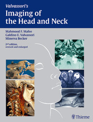 Imaging of the Head and Neck PDF