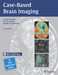 Case-Based Brain Imaging 2nd Edition PDF