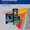 Top 3 Differentials in Neuroradiology 1st Edition PDF