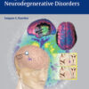 Imaging of Neurodegenerative Disorders 1st Edition PDF