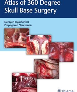 Atlas of 360 degrees Skull Base Surgery PDF