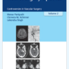 Neurosurgery Updates: Controversies in Vascular Surgery, Volume 2 PDF