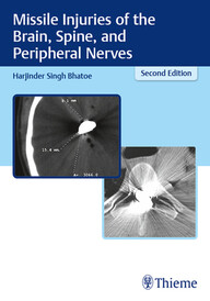 Missile Injuries Of The Brain Spine And Peripheral Nerves 2Ed PDF