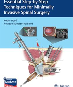 Video Essential Step-by-step Techniques for Minimally Invasive Spinal Surgery 1st Edition