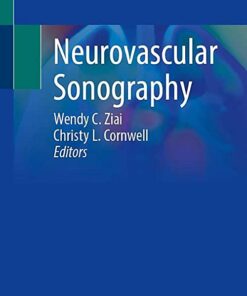 Neurovascular Sonography 1st ed. 2022 Edition PDF Original