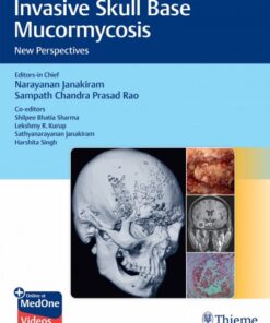 Invasive Skull Base Mucormycosis