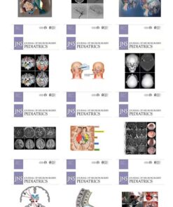 journal of neurosurgery pediatrics 2022 510x841 1