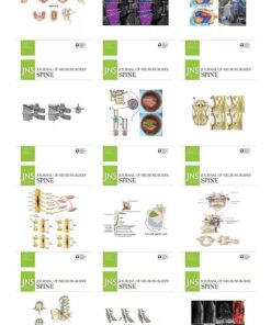 journal of neurosurgery spine 2022 510x842 1