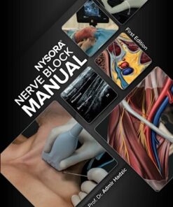 NYSORA Nerve Block Manual