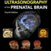 Timor’s Ultrasonography of the Prenatal Brain