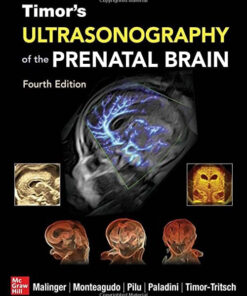 Timor’s Ultrasonography of the Prenatal Brain