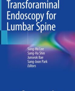 Transforaminal Endoscopy for Lumbar Spine 