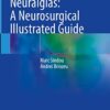 Trigeminal Neuralgias