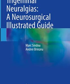 Trigeminal Neuralgias